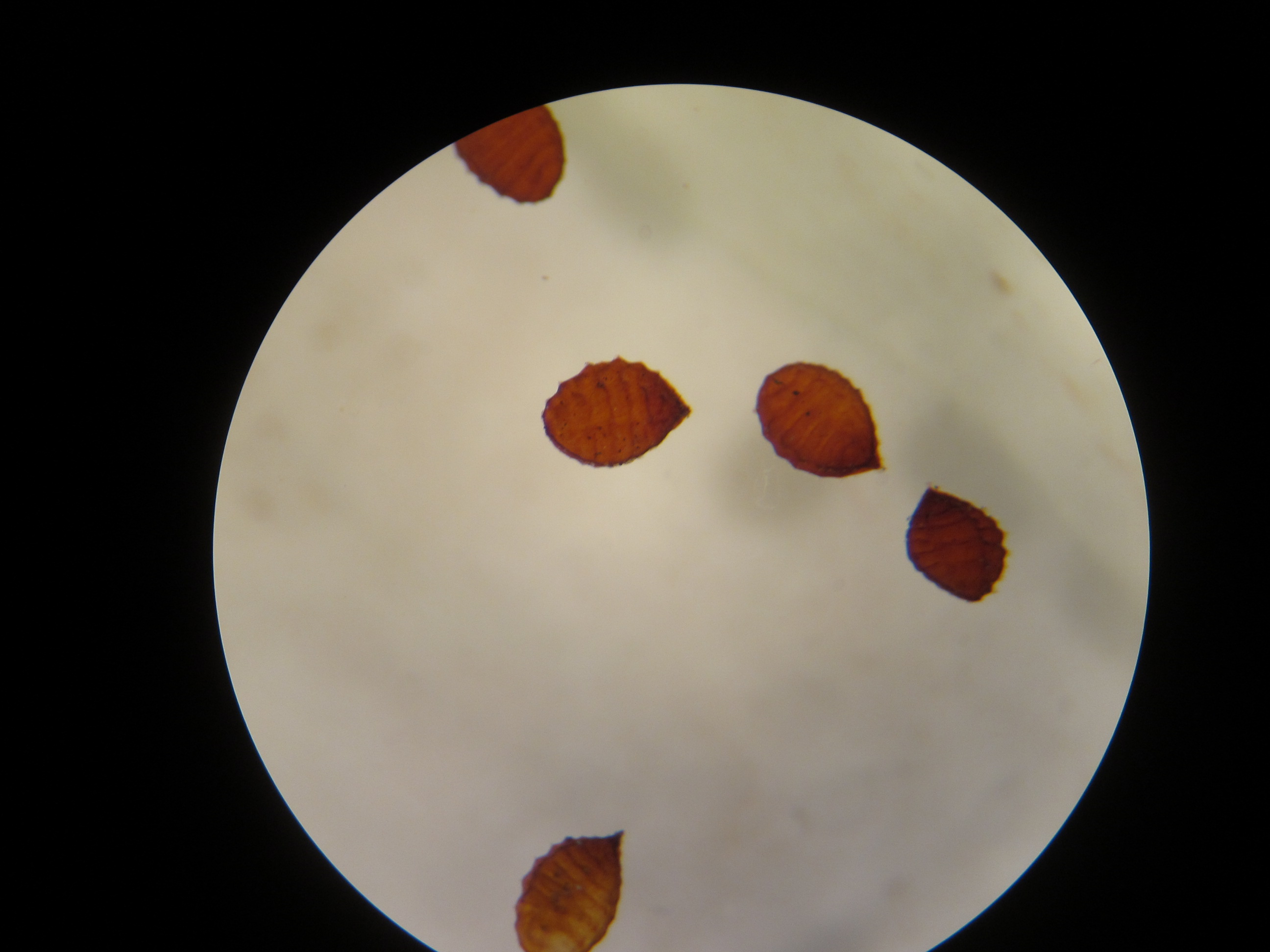 Oxalis seeds under microscope are teardrop shaped
